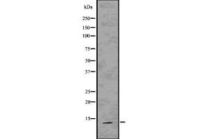 Western blot analysis S100A9 using 293 whole cell lysates (S100A9 Antikörper)