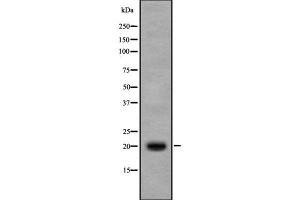 Western blot analysis IL17B using Jurkat whole cell lysates (IL17B Antikörper  (Internal Region))