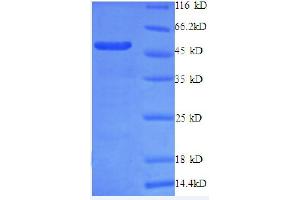 RPL10A Protein (AA 4-215, partial) (GST tag)