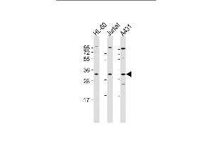 All lanes : Anti-CASP3 Antibody (Center) at 1:2000 dilution Lane 1: HL-60 whole cell lysate Lane 2: Jurkat whole cell lysate Lane 3: A431 whole cell lysate Lysates/proteins at 20 μg per lane. (Caspase 3 Antikörper  (AA 60-90))