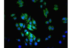 Immunofluorescent analysis of HepG2 cells using ABIN7158764 at dilution of 1:100 and Alexa Fluor 489-congugated AffiniPure Goat Anti-Rabbit IgG(H+L) (Lipase A Antikörper  (AA 22-399))