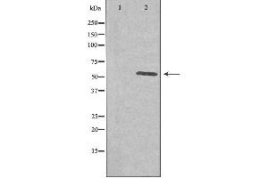 Western blot analysis of extracts from COLO cells using PLK5 antibody.