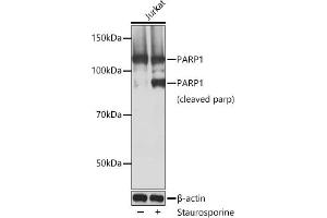 Western blot analysis of extracts of Jurkat cells, using P antibody  at 1:1000 dilution. (PARP1 Antikörper)