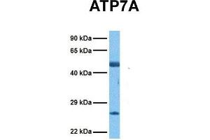 Host:  Rabbit  Target Name:  ATP7A  Sample Tissue:  Human Ovary Tumor  Antibody Dilution:  1. (ATP7A Antikörper  (N-Term))