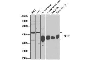 Western blot analysis of extracts of various cell lines, using SIRT2 antibody (ABIN6291363) at 1:1000 dilution. (SIRT2 Antikörper)