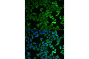 Immunofluorescence analysis of HeLa cell using NPRL2 antibody.
