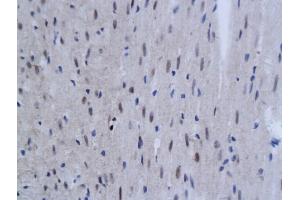 Immunohistochemistry (IHC) image for anti-Tumor Necrosis Factor, alpha-Induced Protein 3 (TNFAIP3) (AA 51-150) antibody (ABIN680938)