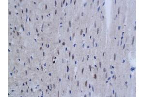 Formalin-fixed and paraffin embedded rat myocardium labeled with Anti-TNFAIP3 Polyclonal Antibody, Unconjugated (ABIN680938) at 1:200 followed by conjugation to the secondary antibody and DAB staining (TNFAIP3 Antikörper  (AA 51-150))