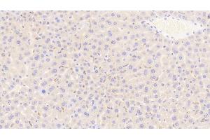 Detection of CD163 in Mouse Liver Tissue using Polyclonal Antibody to Cluster Of Differentiation (CD163) (CD163 Antikörper  (AA 697-972))