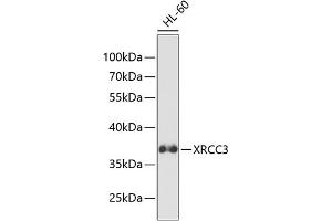 Western blot analysis of extracts of HL-60 cells, using XRCC3 antibody (ABIN3023005, ABIN3023006, ABIN3023007 and ABIN6219342) at 1:1000 dilution. (XRCC3 Antikörper  (AA 62-346))
