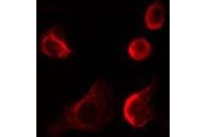 ABIN6278566 staining LOVO cells by IF/ICC. (EIF4E3 Antikörper  (Internal Region))