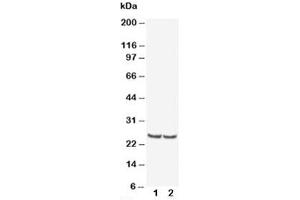 Western blot testing of TIMP4 antibody and Lane 1:  rat kidney (TIMP4 Antikörper  (AA 208-224))