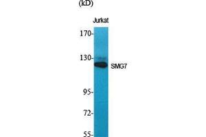 Western Blot (WB) analysis of specific cells using SMG7 Polyclonal Antibody.