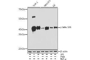 Western blot analysis of extracts of various cell lines, using Phospho-IκBα-S36 Rabbit mAb (ABIN7268992) at 1:1000 dilution. (NFKBIA Antikörper  (pSer36))