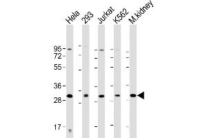 All lanes : Anti-HOXB4 Antibody (Center) at 1:2000 dilution Lane 1: Hela whole cell lysate Lane 2: 293 whole cell lysate Lane 3: Jurkat whole cell lysate Lane 4: K562 whole cell lysate Lane 5: mouse kidney lysate Lysates/proteins at 20 μg per lane. (HOXB4 Antikörper  (AA 138-171))