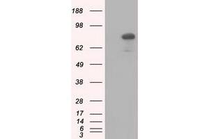 HEK293T cells were transfected with the pCMV6-ENTRY control (Left lane) or pCMV6-ENTRY C17orf28 (Right lane) cDNA for 48 hrs and lysed. (HID1/DMC1 Antikörper)