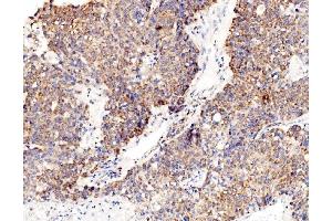 IHC analysis of RPL8 using anti-RPL8 antibody (ABIN7601179). (RPL8 Antikörper  (AA 3-257))