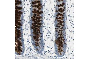 Immunohistochemical staining of human colon shows strong cytoplasmic positivity in glandular cells. (MUC4 Antikörper)