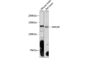 Western blot analysis of extracts of various cell lines, using GM130 Rabbit mAb (ABIN7267494) at 1:1000 dilution. (Golgin A2 (GOLGA2) Antikörper)