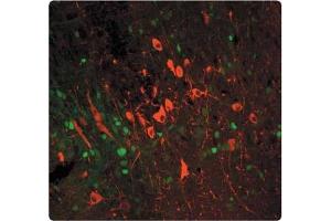 Tissue section through an adult Mouse brain showing TYH (red staining) in catecholaminergic neurons of the substantia nigra (pars compacta). (Tyrosine Hydroxylase Antikörper)