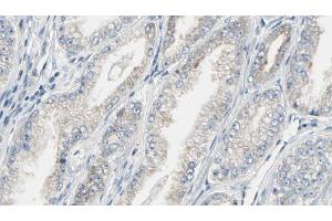 ABIN6269321 at 1/100 staining Human prostate tissue by IHC-P.