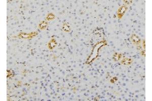 ABIN6279732 at 1/100 staining Mouse kidney tissue by IHC-P. (RAB23 Antikörper  (C-Term))