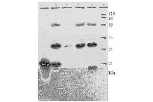 Western Blotting (WB) image for anti-Human Papilloma Virus 18 E7 (HPV-18 E7) (AA 36-70) antibody (ABIN781778) (HPV18 E7 Antikörper  (AA 36-70))