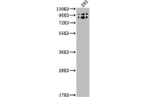 Western Blot Positive WB detected in: 293 whole cell lysate All lanes: BCHE antibody at 1:2000 Secondary Goat polyclonal to rabbit IgG at 1/50000 dilution Predicted band size: 69 kDa Observed band size: 90 kDa (Rekombinanter Butyrylcholinesterase Antikörper)
