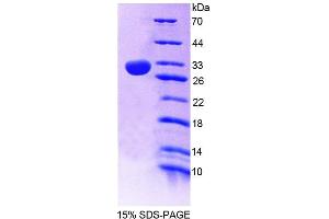 SDS-PAGE analysis of Mouse PLCe1 Protein. (PLCE1 Protein)