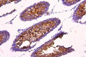 IHC analysis of ACACB using anti-ACACB antibody (ABIN7602757). (Acetyl-CoA Carboxylase beta Antikörper  (C-Term))