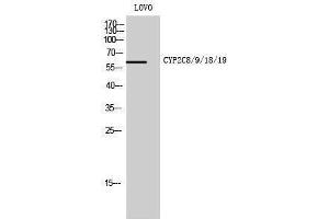 Western Blotting (WB) image for anti-Cytochrome P450, Family 2, Subfamily C, Polypeptide 8/9/18/19 (CYP2C8/9/18/19) (Internal Region) antibody (ABIN3184180) (CYP2C8/9/18/19 Antikörper  (Internal Region))