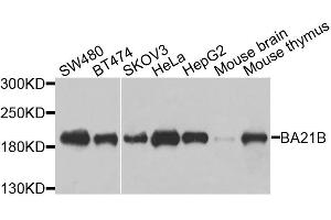 Western blot analysis of extracts of various cell lines, using BAZ1B antibody. (BAZ1B Antikörper)