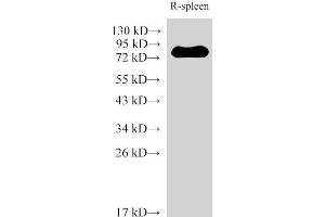 Western Blotting (WB) image for anti-Interleukin 6 Receptor (IL6R) antibody (ABIN7234279)