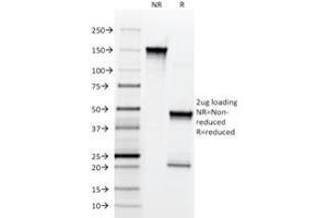 SDS-PAGE Analysis Purified NGFR Mouse Monoclonal Antibody (NGFR5). (NGFR Antikörper)