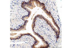 IHC analysis of ITGA5 using anti-ITGA5 antibody (ABIN5693202).