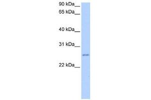 RPESP antibody used at 2 ug/ml to detect target protein. (RPESP Antikörper  (C-Term))