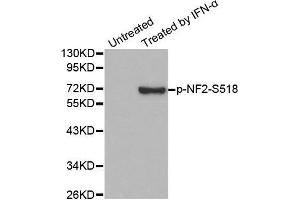 Western blot analysis of extracts from HUVEC cells, using Phospho-NF2-S518 antibody. (Merlin Antikörper  (pSer518))