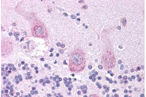 Immunohistochemistry (Paraffin-embedded Sections) (IHC (p)) image for anti-Cholinergic Receptor, Nicotinic, alpha 3 (Neuronal) (CHRNA3) (AA 26-75) antibody (ABIN6736366)