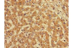 Immunohistochemistry of paraffin-embedded human liver cancer using ABIN7165226 at dilution of 1:100 (CUTA Antikörper  (AA 33-150))