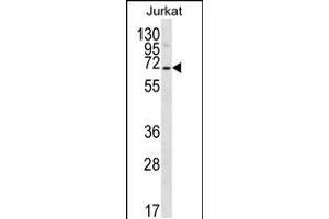 Western blot analysis in Jurkat cell line lysates (35ug/lane). (PSAPL1 Antikörper  (N-Term))