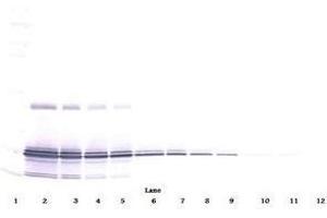Image no. 1 for anti-Interleukin 11 (IL11) antibody (ABIN465144) (IL-11 Antikörper)
