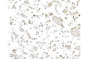 Immunocytochemistry (ICC) image for anti-gamma Histone Variant H2AX (GAMMA-H2AX) (Ser140) antibody (ABIN7454026) (Rekombinanter gamma H2AX Antikörper  (Ser140))