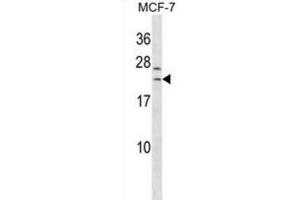 Western Blotting (WB) image for anti-SAP30-Like (SAP30L) antibody (ABIN3000391) (SAP30L Antikörper)