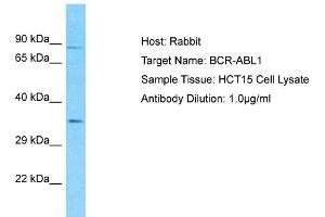 Host: Rabbit Target Name: BCR-ABL1 Sample Type: HCT15 Whole Cell lysates Antibody Dilution: 1. (Oncogene Protein p190/bcr-Abl (N-Term) Antikörper)