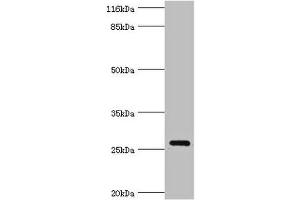 Western blot All lanes: OFCC1 antibody at 2 μg/mL + Mouse gonadal tissue Secondary Goat polyclonal to rabbit IgG at 1/10000 dilution Predicted band size: 27, 32, 21, 14, 16 kDa Observed band size: 27 kDa (OFCC1 Antikörper  (AA 3-231))