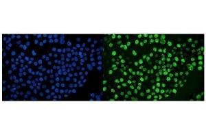 IF analysis of Ki67 using anti-Ki67 antibody (ABIN7601100).