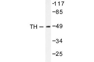 Image no. 1 for anti-Tyrosine Hydroxylase (TH) antibody (ABIN271856) (Tyrosine Hydroxylase Antikörper)