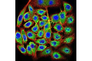 Immunocytochemistry (ICC) image for anti-Transcription Termination Factor, RNA Polymerase I (TTF1) (AA 1-150) antibody (ABIN5871603) (TTF1 Antikörper  (AA 1-150))