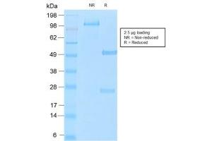 SDS-PAGE analysis of purified, BSA-free recombinant MUC16 antibody (clone OCA125/2349R) as confirmation of integrity and purity. (MUC16 Antikörper)