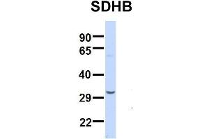 Host:  Rabbit  Target Name:  SERPINA3  Sample Type:  Human Adult Placenta  Antibody Dilution:  1. (SDHB Antikörper  (Middle Region))